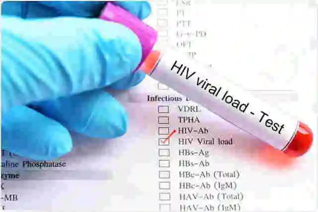 HIV ပိုးကောင်ရေစစ်ဆေးခြင်း💉